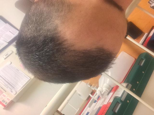 4 months