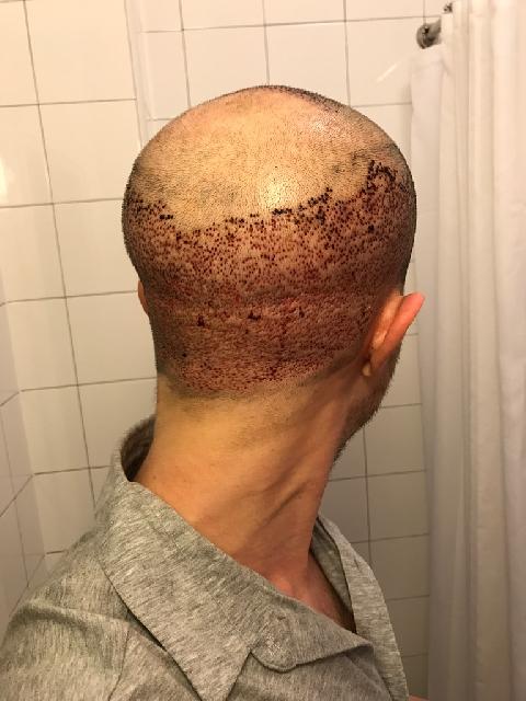 Donor dag 2