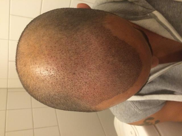 Efter 3