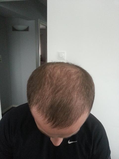 Efter ca 7 v
