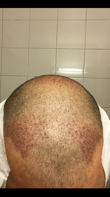Efter ht 2