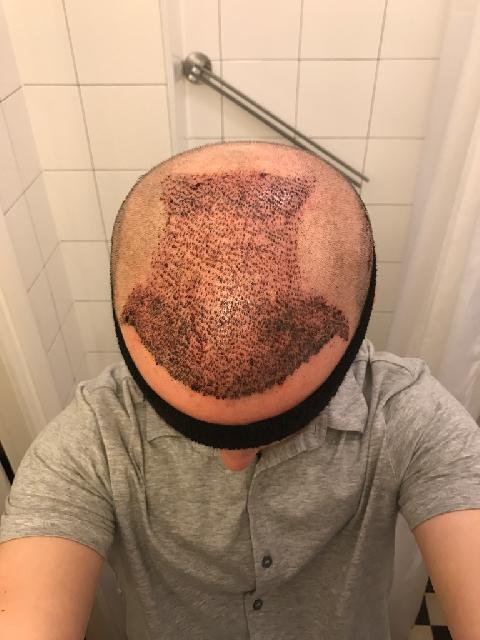 Reci dag 2
