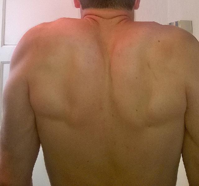 Shrug scapula