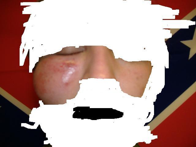 Skadan